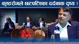 कुुष्ठरोगको डरलाग्दो रुप ! हजारौं कुष्ठरोगी छटपटाहटमा 