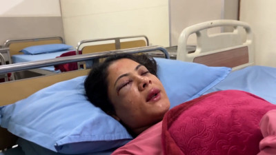 शिक्षक–प्रहरी झडपमा पत्रकार कार्की गम्भीर घाइते, तिलगंगामा उपचार हुँदै