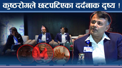 कुुष्ठरोगको डरलाग्दो रुप ! हजारौं कुष्ठरोगी छटपटाहटमा 