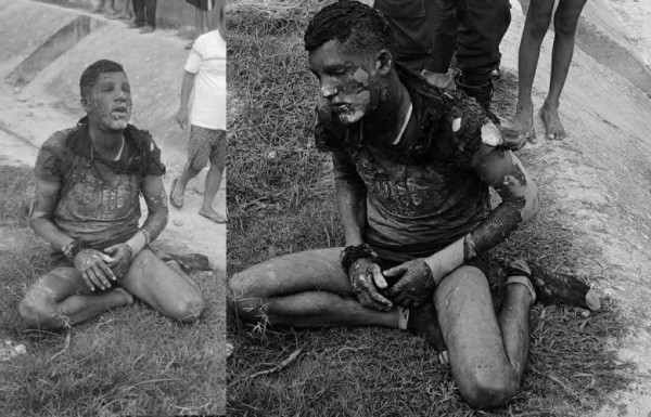 रुबिको हत्या आरोपी जलेर घाइते भएको अवस्थामा फेला